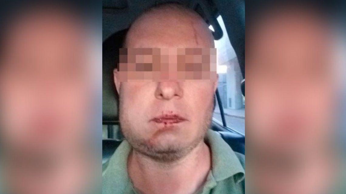 carlos-galindez-fue-brutalmente-golpeado-la-policia