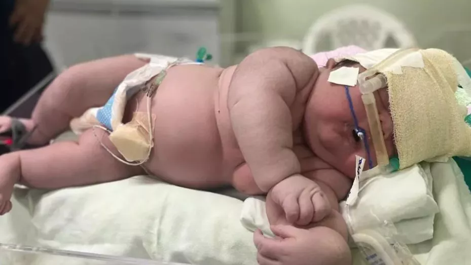 bebe-7kg