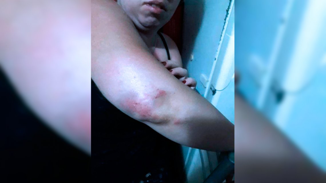 golpe