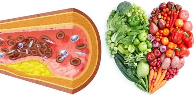 consejos-para-prevenir-el-colesterol-malo
