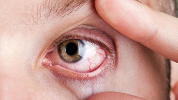 ojo