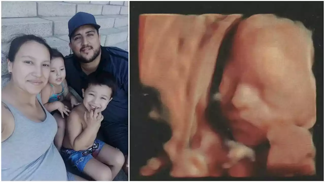 una-familia-pide-ayuda-para-una-beba-por-nacer-que-una-familia-pide-ayuda-para-una-beba-por-nacer-que-1627246672941133824